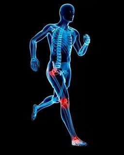 Arthritis and joint pain